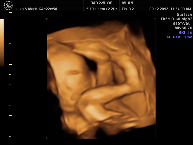 Sunday 9th December 2012 (22 weeks)