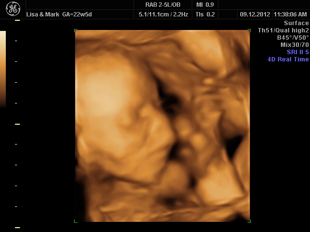 Sunday 9th December 2012 (22 weeks)