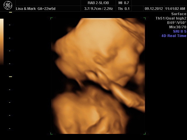 Sunday 9th December 2012 (22 weeks)