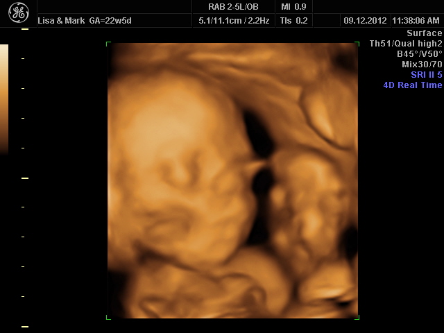 Sunday 9th December 2012 (22 weeks)