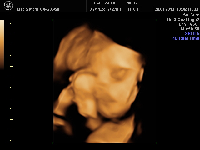 Sunday 20th January 2013 (28 weeks)